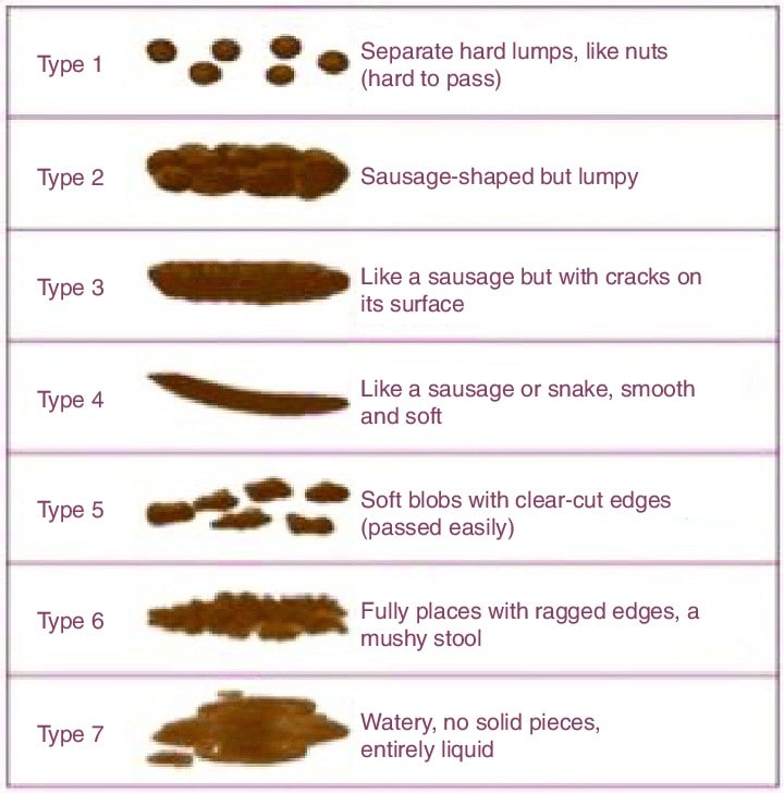 endometriosis excision surgery