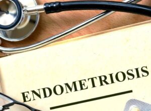 Endometriosis Medication